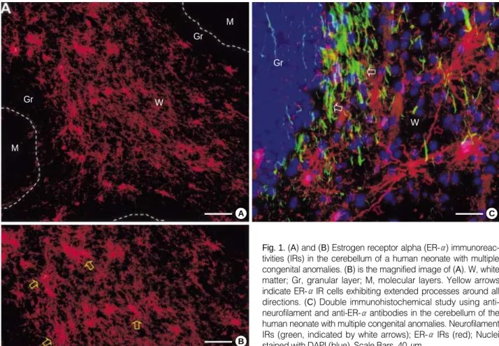 Fig. 1. (A) and (B) Estrogen receptor alpha (ER- ) immunoreac- immunoreac-tivities (IRs) in the cerebellum of a human neonate with multiple congenital anomalies