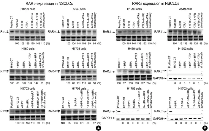 Fig. 4. Northern analysis of the expressions of RARs after treating NSCLC cell lines with 4-HPR and other retinoids (ATRA, 13-cisRA, or 9-cisRA) singly or in combination