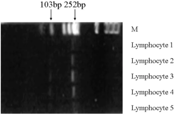 Fig. 4. Sal  I  digestion  pattern  of  the  reverse-  transcriptase-PCR  products  from  CDKN2  mRNA  of  normal  peripheral  blood  lymphocytes