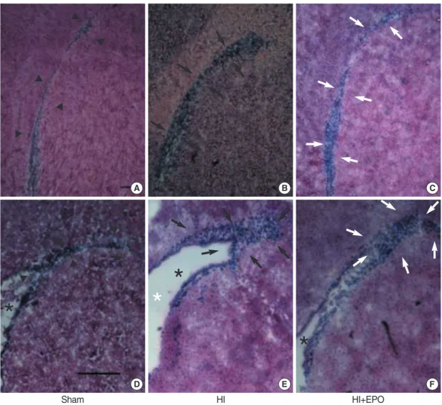 Fig. 2. Morphological changes of subventricular zone (SVZ) of the ipsilateral brain of rats at 2 weeks after insult (P21)