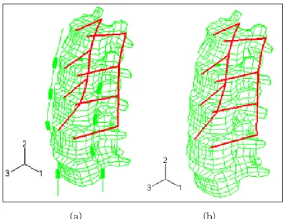Fig. 1. Finite  element  model  of  3-level  fused  lumbar  spine  under.