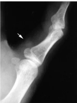 Fig. 3. Photomicrograph  shows  multiple  foci  of  calcification  (Hematoxylin-eosin  stain,  x100).