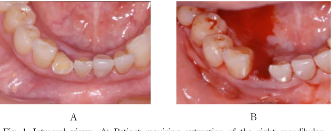 Fig. 2. Periapical  radiographs  immediately  after  implant  placement. 