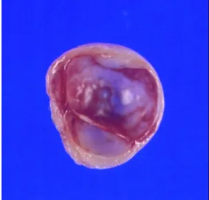 Fig. 4. It  consists  of  a  round  smooth  cystic  lesion,  measuring  1.3  cm  in  diameter