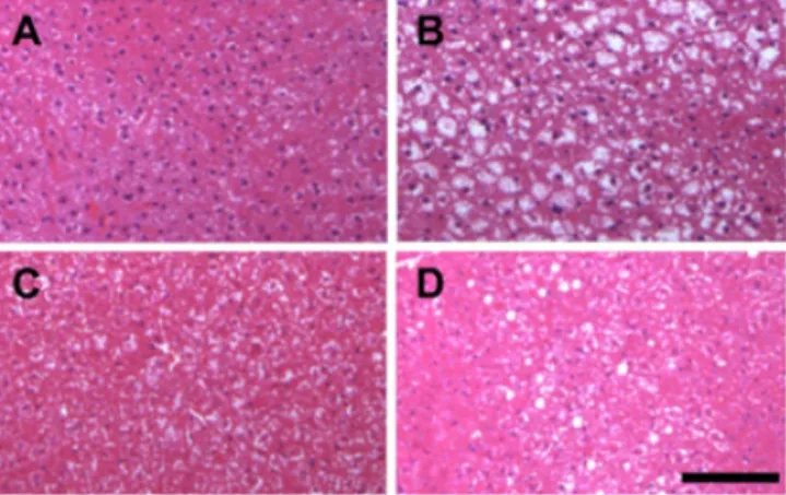 Fig. 1. Effect of fucoidan on hepatic tissue morphology. Representative picture of H &amp; E stained sections of liver tissue from normal control (A), 25% ethanol (B), 25% ethanol treated with 250 mg/kg BW fucoidan (C), and 25% ethanol treated with 500 mg/