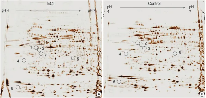 Fig. 1. Two-dimensional gel electrophoresis patterns of proteins from the ECT-treated rat brain tissue (A) and normal control brain tissue (B).