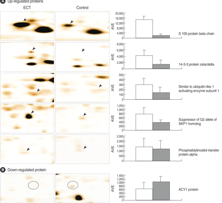Fig. 3. 2-DE patterns showing up-regulated protein spots (A, indicated by arrowheads) and down-regulated spot (B, indicated by circle) in ECT-treated rat brain tissues (left panel) compared with control brain tissues (middle panel)