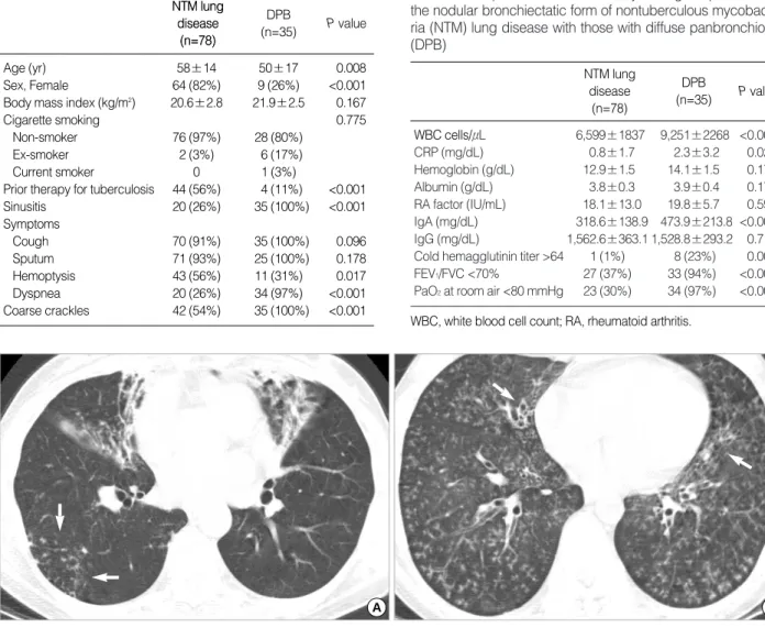 Fig. 1. Typical radiographic presentations of the nodular bronchiectatic form of nontuberculous mycobacterial lung disease and diffuse panbronchiolitis