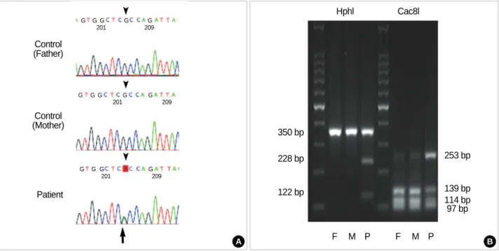 Fig. 3. Mutation analysis of the ACVR1 in FOP patients with definite clinical manifestations