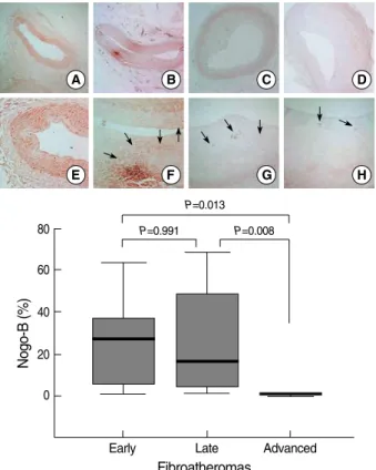 Fig. 5. Nogo-B expression with plaque growth. Early fibroathero- fibroathero-mas (FA) (B and F) showed diffuse Nogo-B expression (arrows) comparable to that seen in controls (A and E)