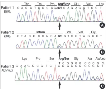 Fig. 5. Sequencing results of three mutation-positive patients with HHT. (A) ENG c.277C>T (p.Arg93X) in patient 1; (B) ENG  c.992-1G>C (splicing defect) in patient 2; (C) ACVRL1 c.81dupT (p