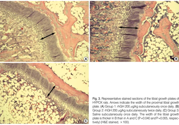 Fig. 3. Representative stained sections of the tibial growth plates of HYPOX rats. Arrows indicate the width of the proximal tibial growth plate