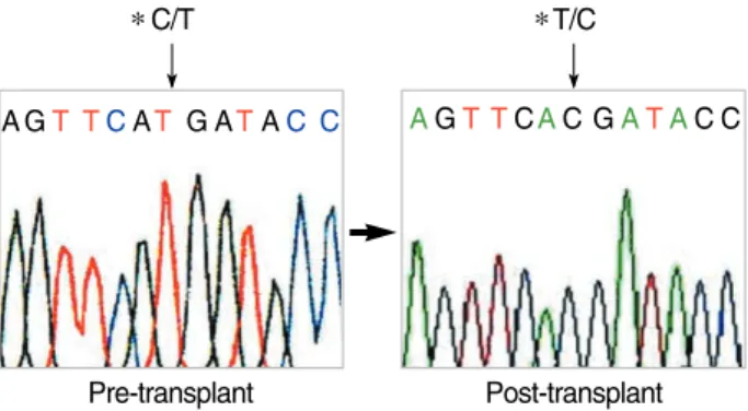 Fig. 1. Sequence analysis showing genetic correction of the WASP gene in UPN 1. DNA sequences are shown that encompass a  sin-gle point mutation (C to T) or a correction in exon 7 of the WASP gene