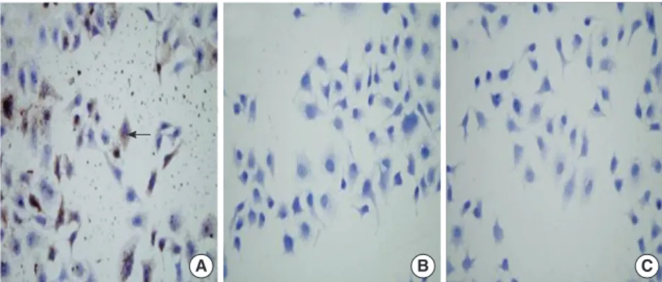 Fig. 2. Immunocytochemistry of Pim-2 protein in the three  groups of cells. Buffy materials (arrow shows) are found in  the cytoplasm and nucleus of the L02/Pim-2 group cells  (A) but not in the L02/vector group (B) and L02 group (C)