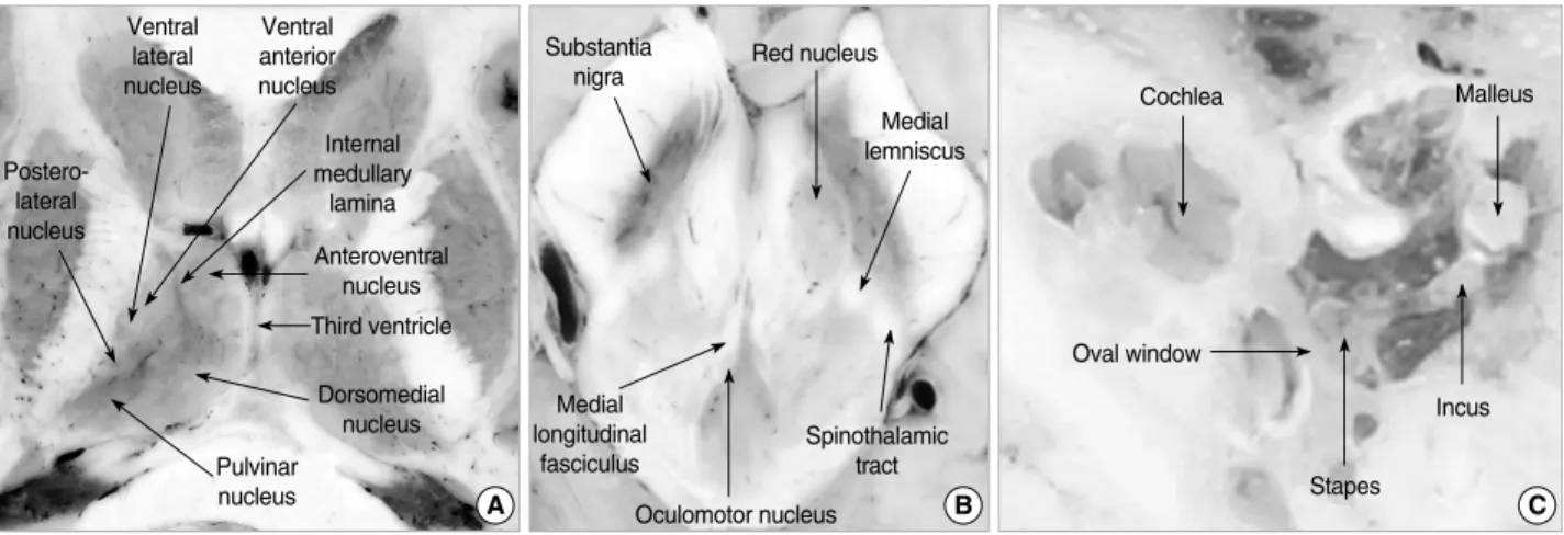 Fig. 3. Zoomed-in axial serially-sectioned images showing (A) the nuclei of thalamus, (B) the nuclei and tracts in midbrain, and (C) the small structures in the left ear.