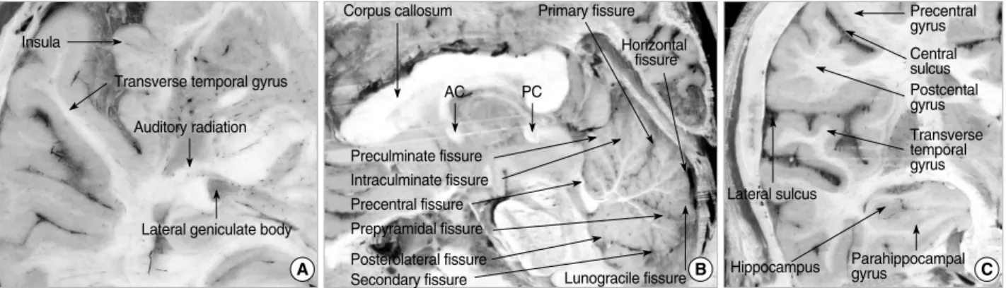 Fig. 7. Zoomed-in (A) axial, (B) sagittal, and (C) coronal reference planes showing important brain structures.