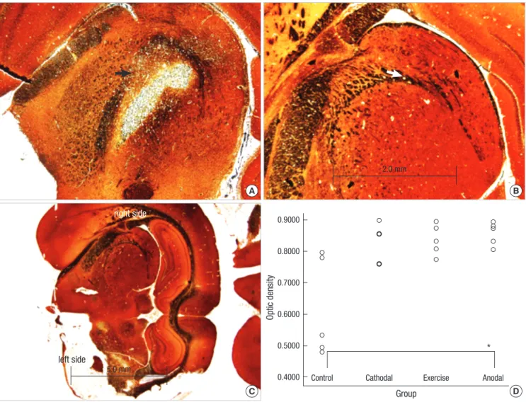 Fig. 5. Representative photomicrographs from bilateral internal capsules showing neural axons staining with Bielschowsky’s method in rat stroke model (original magnification 