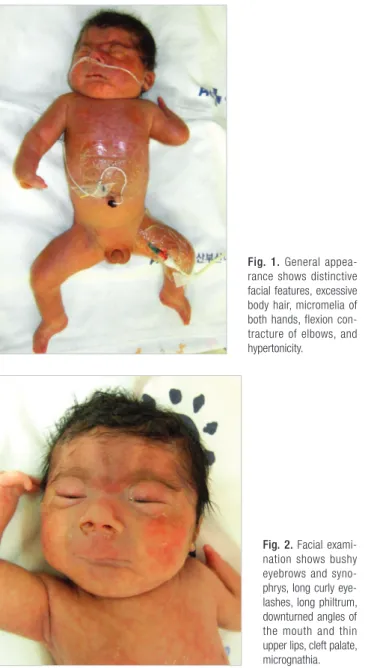Fig. 2. Facial exami­
