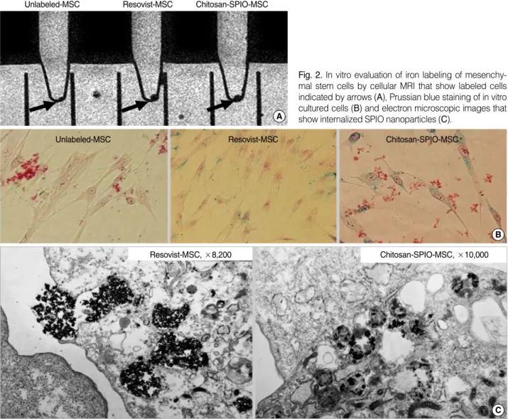 Fig. 2. In vitro evaluation of iron labeling of mesenchy- mesenchy-mal stem cells by cellular MRI that show labeled cells indicated by arrows (A), Prussian blue staining of in vitro cultured cells (B) and electron microscopic images that show internalized 