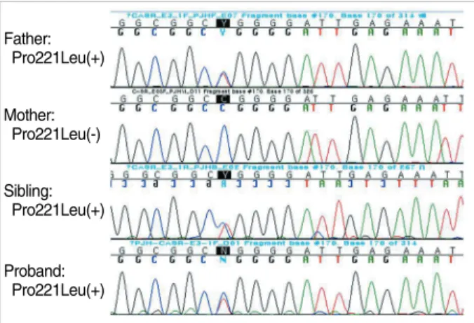 Fig. 2. Direct sequencing of the calcium-sensing receptor (CaSR) gene.