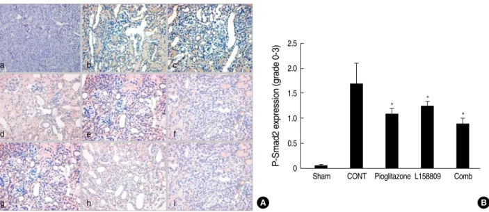 Fig. 5. P-Smad2 expression by Immunohistochemical staining. P-Smad2 is detected at the nuclei of tubular epithelial cells and interstitial inflammatory cells