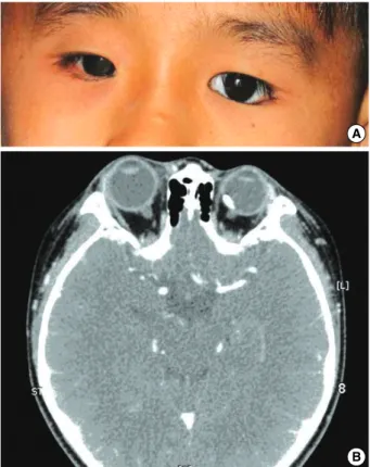 Fig. 1. Overall and ocular survival.