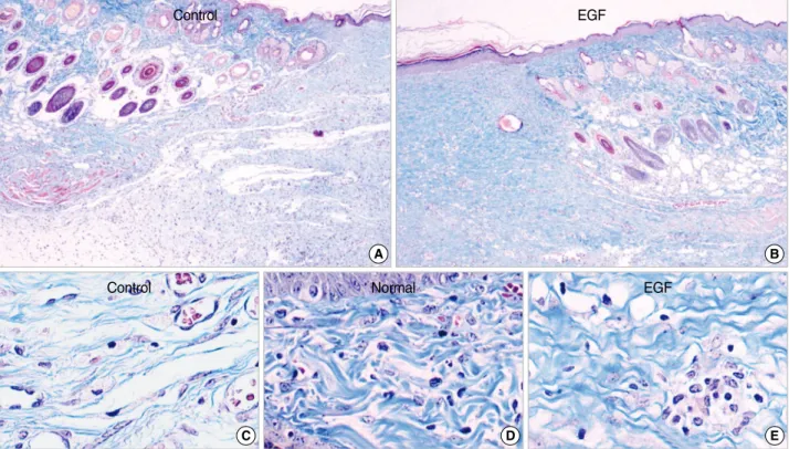 Fig. 5. Immunohistochemical observation of full-thickness wound at 4 days. The immunoactive area of TGF- b 1 (brown) is markedly increased in the control group, especially in the stroma (A, C)