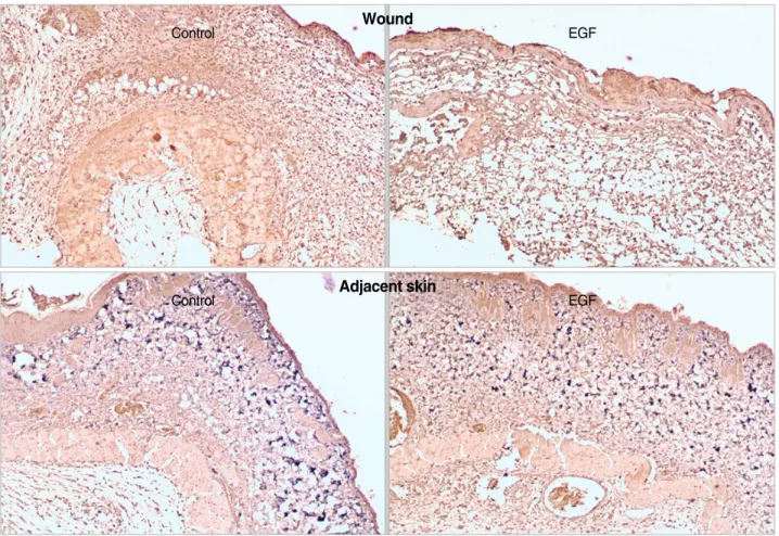 Fig. 6. Trichrome staining for collagen pattern in each group at 3 weeks. In the EGF-treated group, the epidermis is well established