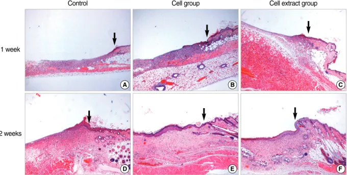 Fig. 4. Micrographs of wound bed and wound margin in each group at 1 and 2 weeks after wounding (H&amp;E stain, 40)