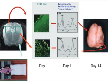 Fig. 1. Schematic diagram illustrating the hypoxic-ischemic animal model. One day  after hypoxic-ischemic injury, the number of TUNEL-positive cells and the lipid peak  on  1 H MRS in the right brain markedly increase