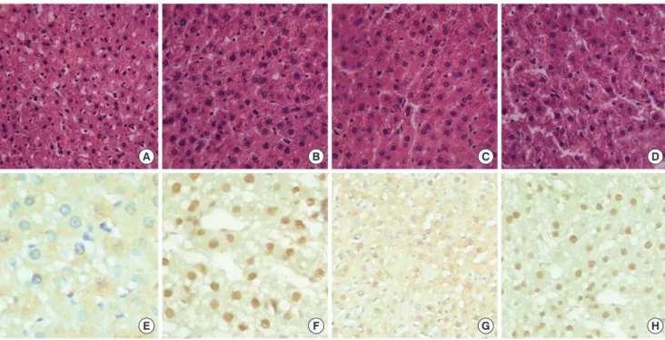 Fig. 1. HE staining and NF- κB expression of liver tissues from four studied groups. (A) HE staining in NC group