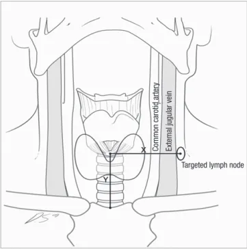 Fig. 1. Schematic figure of the X axis and Y axis. The lymph node is targeted accord- accord-ing to the location in the axial plane of CT, with the Y axis defined as the distance  from the sternum to the target lymph node, and the X axis is as the distance
