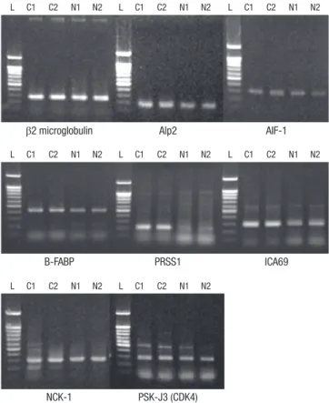Fig. 1. Comparison of 2D PAGE proteins separated from cervical cancer tissue and  normal cervical tissue samples