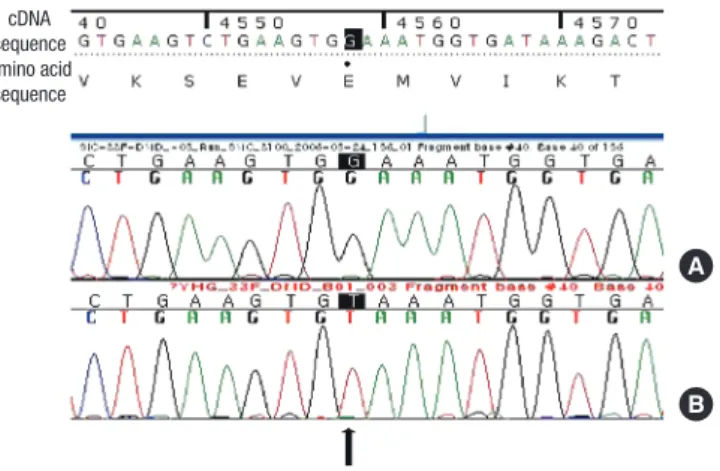 Fig. 4. Direct DNA sequencing of exon 33. The arrow indicates the hemizygous G to  T transversion at nucleotide 4558 in exon 33 (c.4558G > T;Glu1520X) of the  dystro-phin gene of case 20
