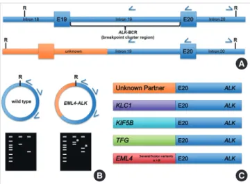 Fig. 1. Schematic representation of long distance inverse-polymerase chain reaction  (LDI-PCR) for analyzing ALK rearrangements