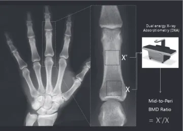 Fig. 1. Evaluation of localized articular and periarticular ROIs with DXA. We labeled  left and right hands with L and R, respectively, which were followed by numbers (x)  from 1 to 4 for periarticular BMDs and 1´ to 4´ for middle-of-the-bone BMDs