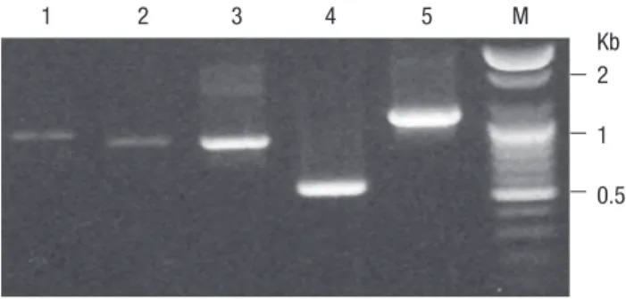 Fig. 1. PCR amplification of antigenic genes from O. tsutsugamushi strains, Gilliam  (lane 1: 952 bp), Karp (lane 2: 873 bp), Kato (lane 3: 886 bp), Boryoung (lane 4: 549  bp) and Kangwon 87-61 (lane 5: 1,086 bp) strains