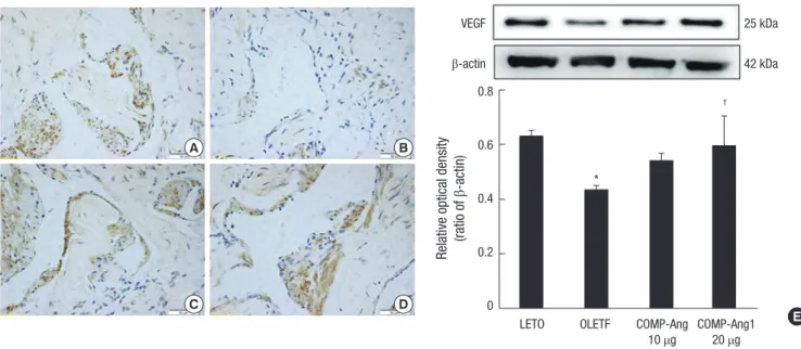 Fig. 2. Immunohistochemical study of the expression of VEGF in penis tissue from the LETO (A), OLETF (B), OLETF+10 µg COMP-Ang1 (C), and OLETF+20 µg COMP-Ang1 (D)  groups