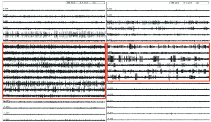 Fig. 3. Typical bursting patterns (see the boxes). The typical bursting patterns are demonstrated according to anesthetic methods