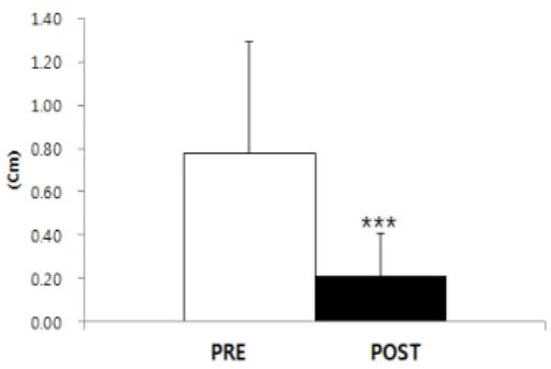Fig. 3. Width Differences between Right and Left Iliac  Crests