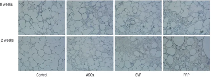 Fig. 4. Representative images of CD31 antibody staining. Neovasculature structures were observed on the side with adjuvants at all time points