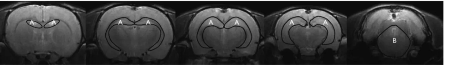 Fig. 2. Representative regions of interest (ROIs) drawn on coronal T2-weighted MRI. (A) Hippocampus