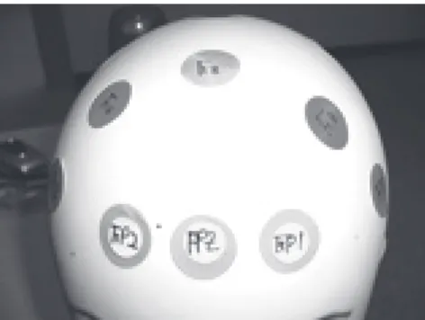 Figure 1. International 10-20 system. Figure 2. Position of Fp1, Fpz &amp; Fp2. 