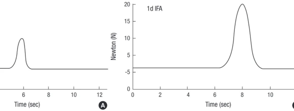 Fig. 2. Bite force voltage output wave through the computer monitor (A, B).