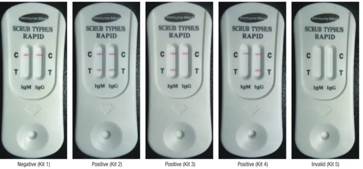 Fig. 1. Representative pictures for RDT indicating negative and positive results. Red colorization of the test line (T) indicates the presence of human antibody against O
