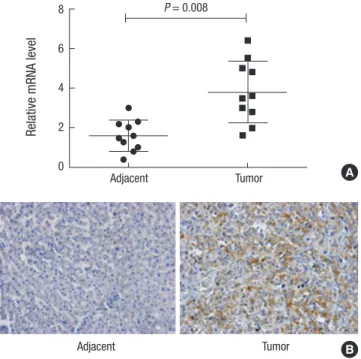 Fig. 1. OTX1 is highly expressed in clinical HCC tissues. (A) qRT-PCR analysis showed  that the average mRNA level of OTX1 in the tumor tissues were approximately  two-fold increased compared with the paired non-cancerous tissues (P = 0.008)