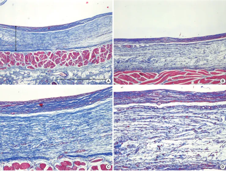 Fig. 2. The fibrosis ratio was significantly different at 32.33%±10.38% in the simv- simv-astatin group and 58.44%±15.69% in the control group (P < 0.001)
