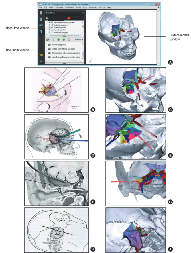 Fig. 3. In the PDF file, windows showing each 3D model and bookmarks of clinical trials