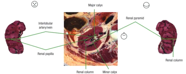Fig. 1. The peeled (-12 mm) model of right kidney reconstructed by computer software (left and right)