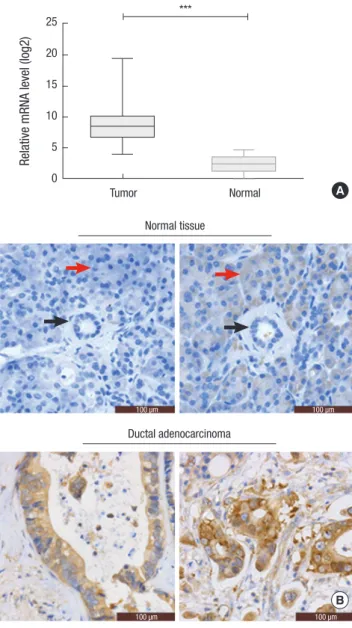 Table 1. Association between eIF3a expression and the clinicopathological variables  in 140 cases of pancreatic ductal adenocarcinoma